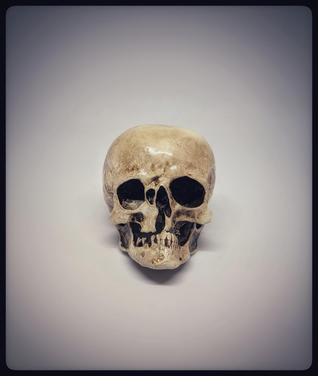 Craniosynostosis Skull 3D Resin Model 2.76x2.95in (7x7.5 cm) Anatomical