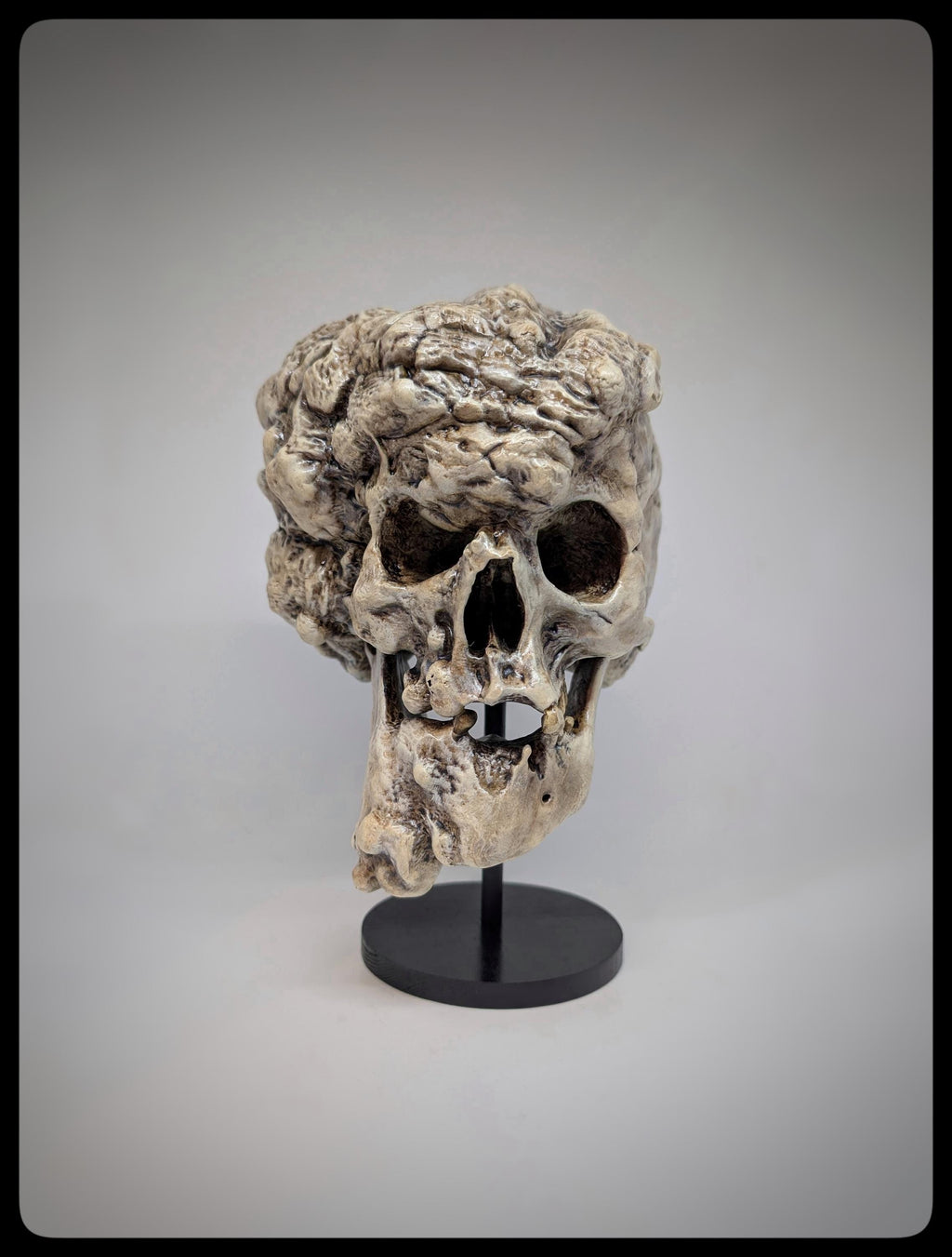 Joseph Merrick Skull 3D Resin Sculpture – 3D Sculpt by Carlito Brigante