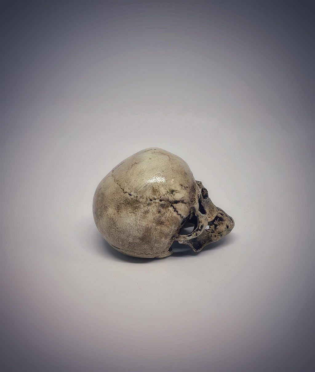 Small Craniosynostosis Skull 3D Resin 1.77 "(4.5 cm) x 2.36"(6 cm) Anatomical