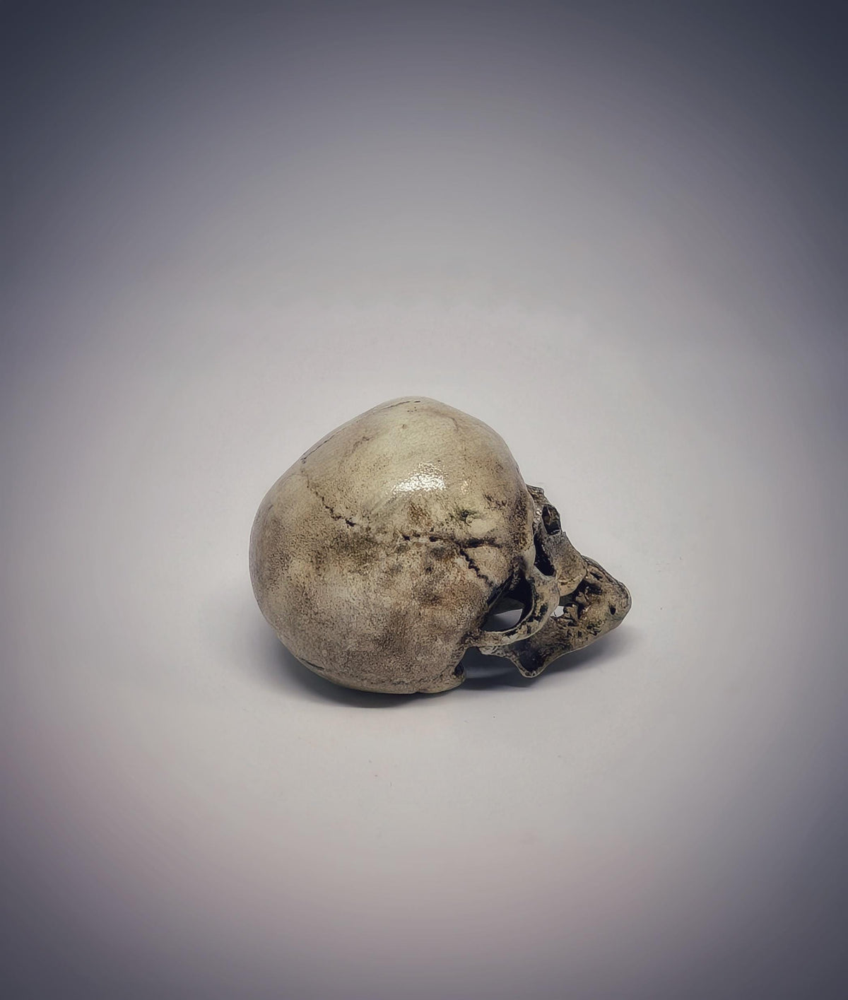 Small Craniosynostosis Skull 3D Resin 1.77 "(4.5 cm) x 2.36"(6 cm) Anatomical