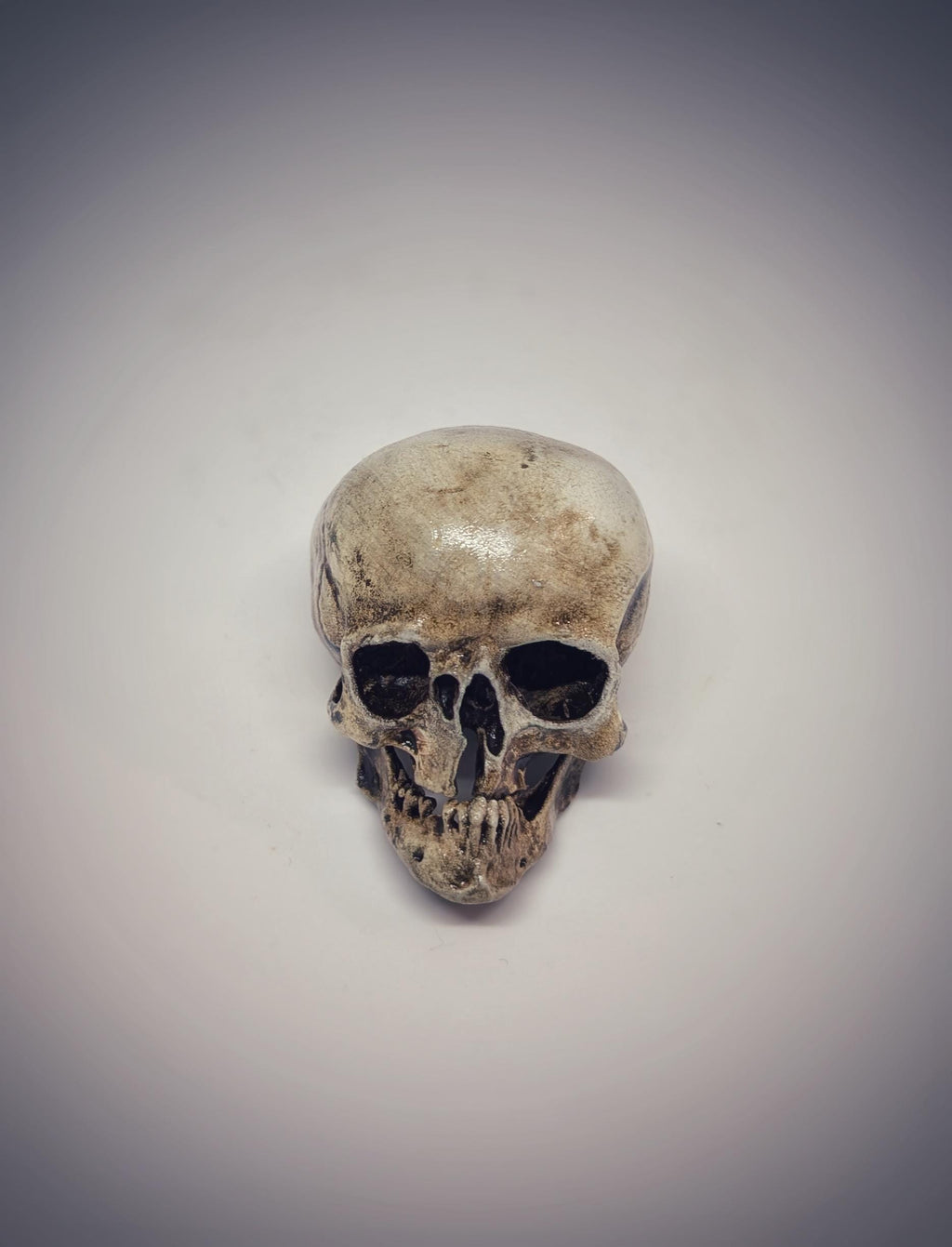 Small Craniosynostosis Skull 3D Resin 1.77 "(4.5 cm) x 2.36"(6 cm) Anatomical