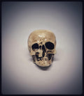 Craniosynostosis Skull 3D Resin Model 2.76x2.95in (7x7.5 cm) Anatomical