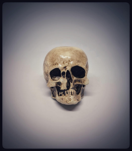 Craniosynostosis Skull 3D Resin Model 2.76x2.95in (7x7.5 cm) Anatomical