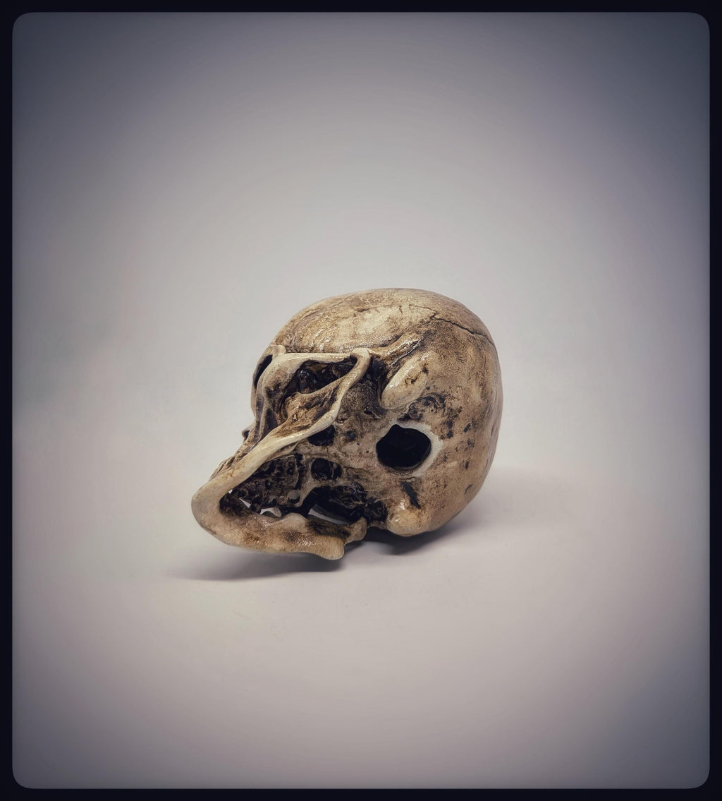 Craniosynostosis Skull 3D Resin Model 2.76x2.95in (7x7.5 cm) Anatomical