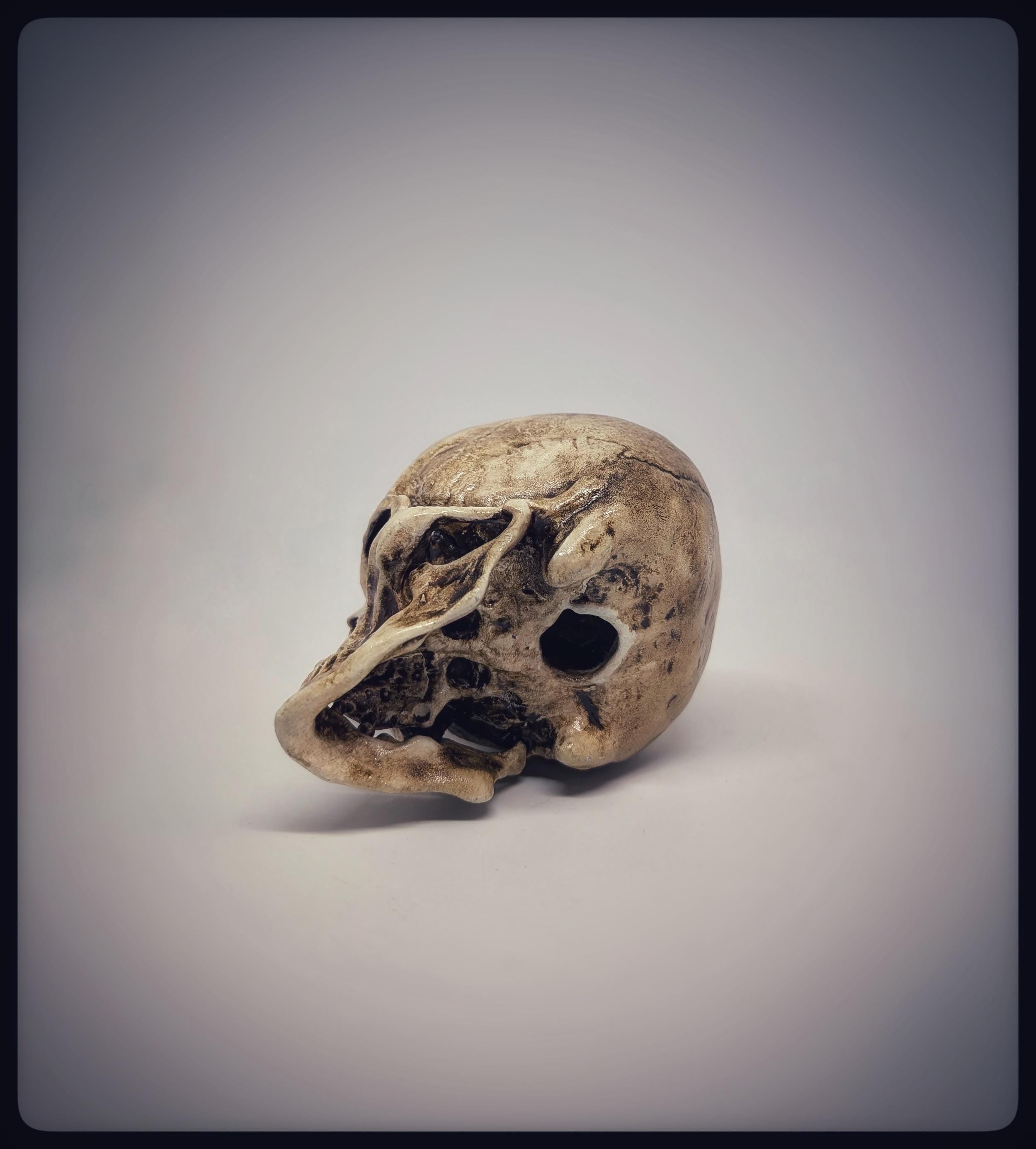 Craniosynostosis Skull 3D Resin Model 2.76x2.95in (7x7.5 cm) Anatomical