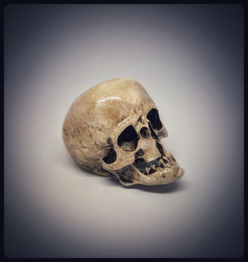 Craniosynostosis Skull 3D Resin Model 2.76x2.95in (7x7.5 cm) Anatomical