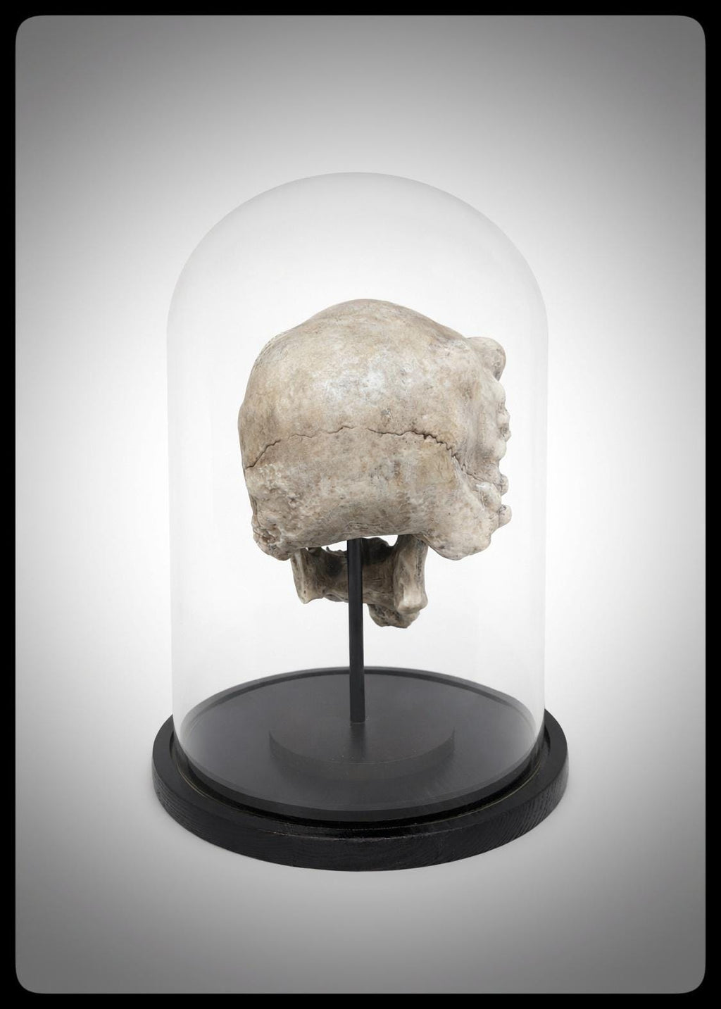 Joseph Merrick Skull 3D Resin Sculpture – 3D Sculpt by Carlito Brigante