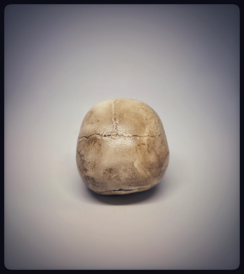 Craniosynostosis Skull 3D Resin Model 2.76x2.95in (7x7.5 cm) Anatomical