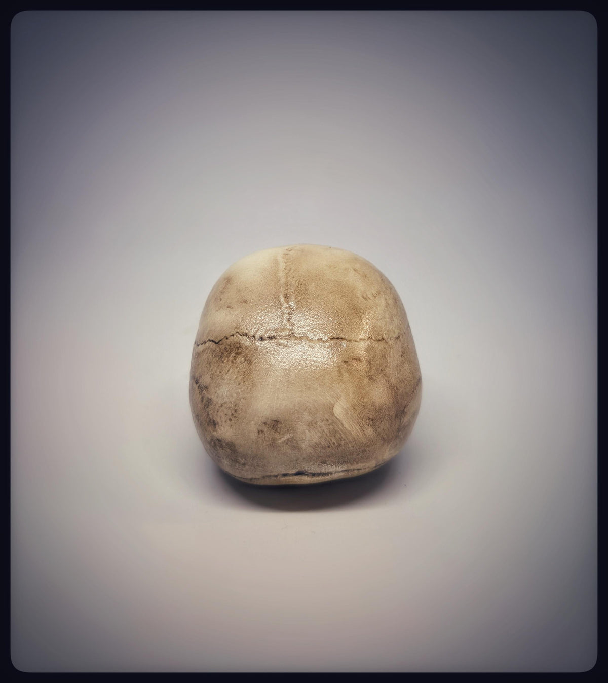 Craniosynostosis Skull 3D Resin Model 2.76x2.95in (7x7.5 cm) Anatomical
