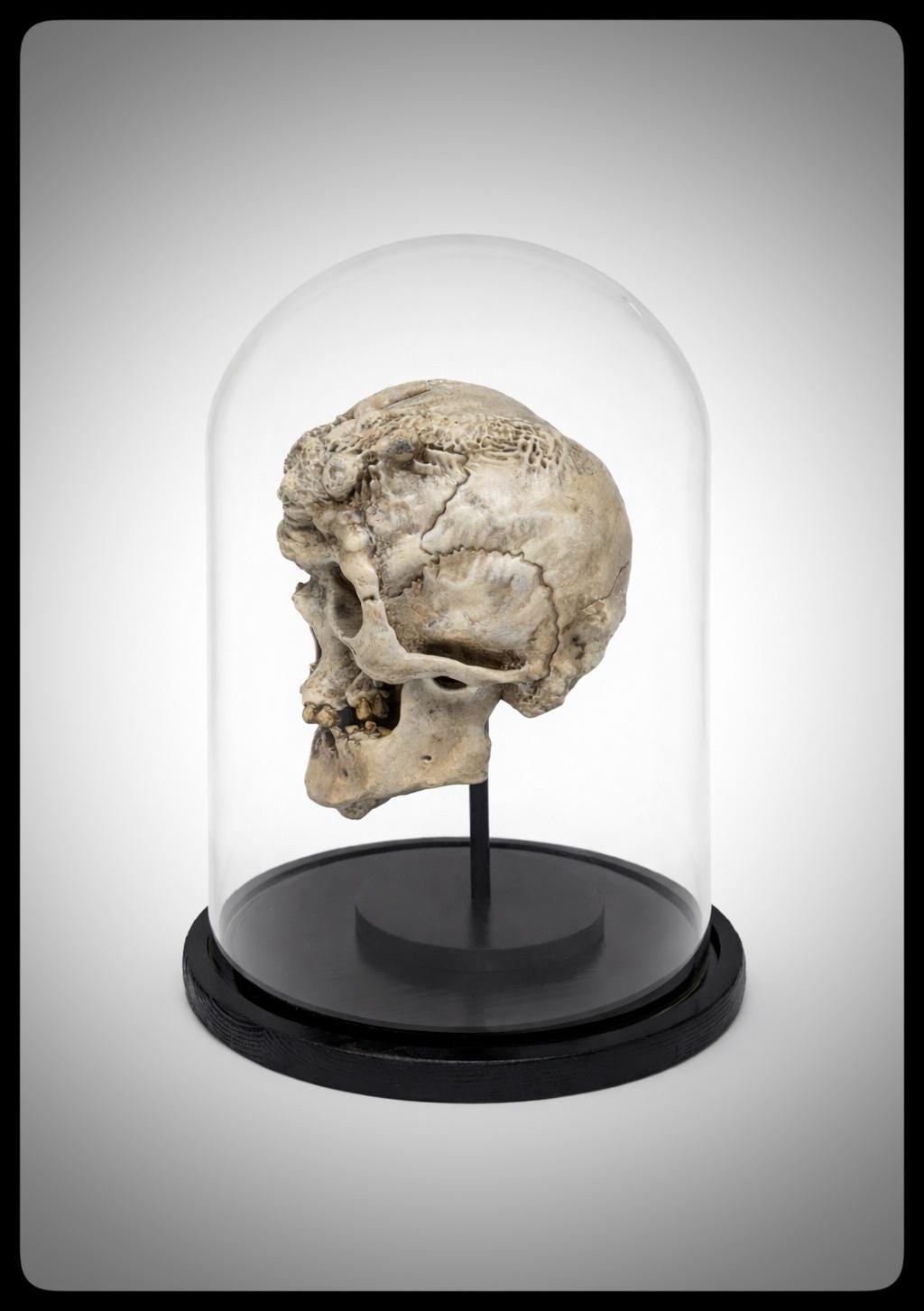 Joseph Merrick Skull 3D Resin Sculpture – 3D Sculpt by Carlito Brigante