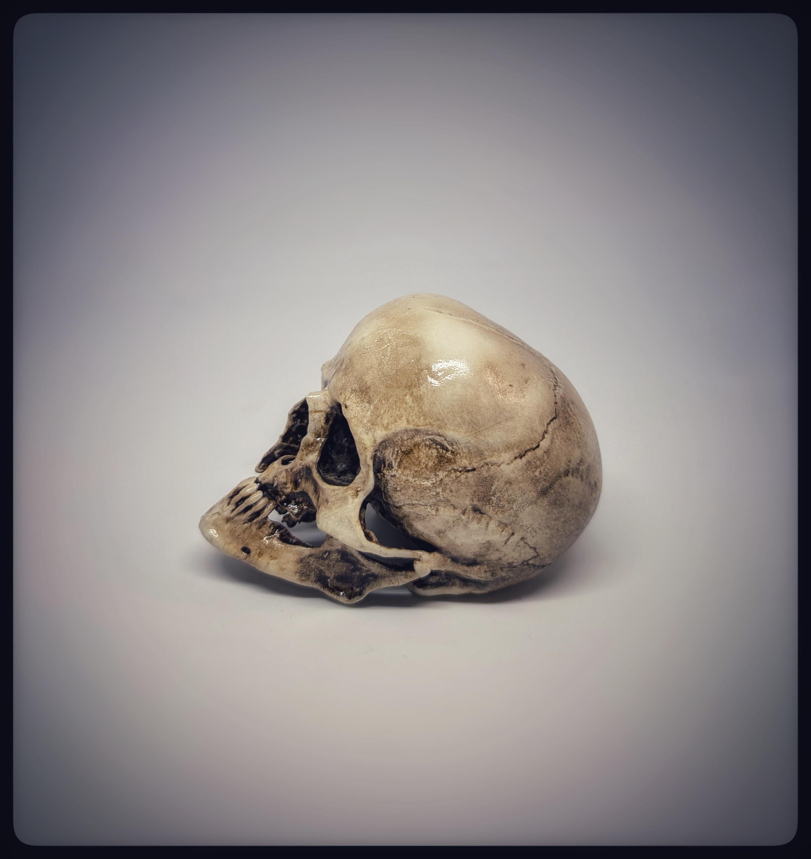 Craniosynostosis Skull 3D Resin Model 2.76x2.95in (7x7.5 cm) Anatomical