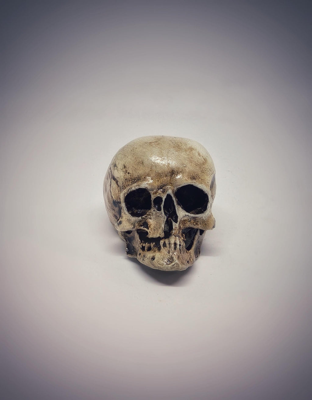 Small Craniosynostosis Skull 3D Resin 1.77 "(4.5 cm) x 2.36"(6 cm) Anatomical