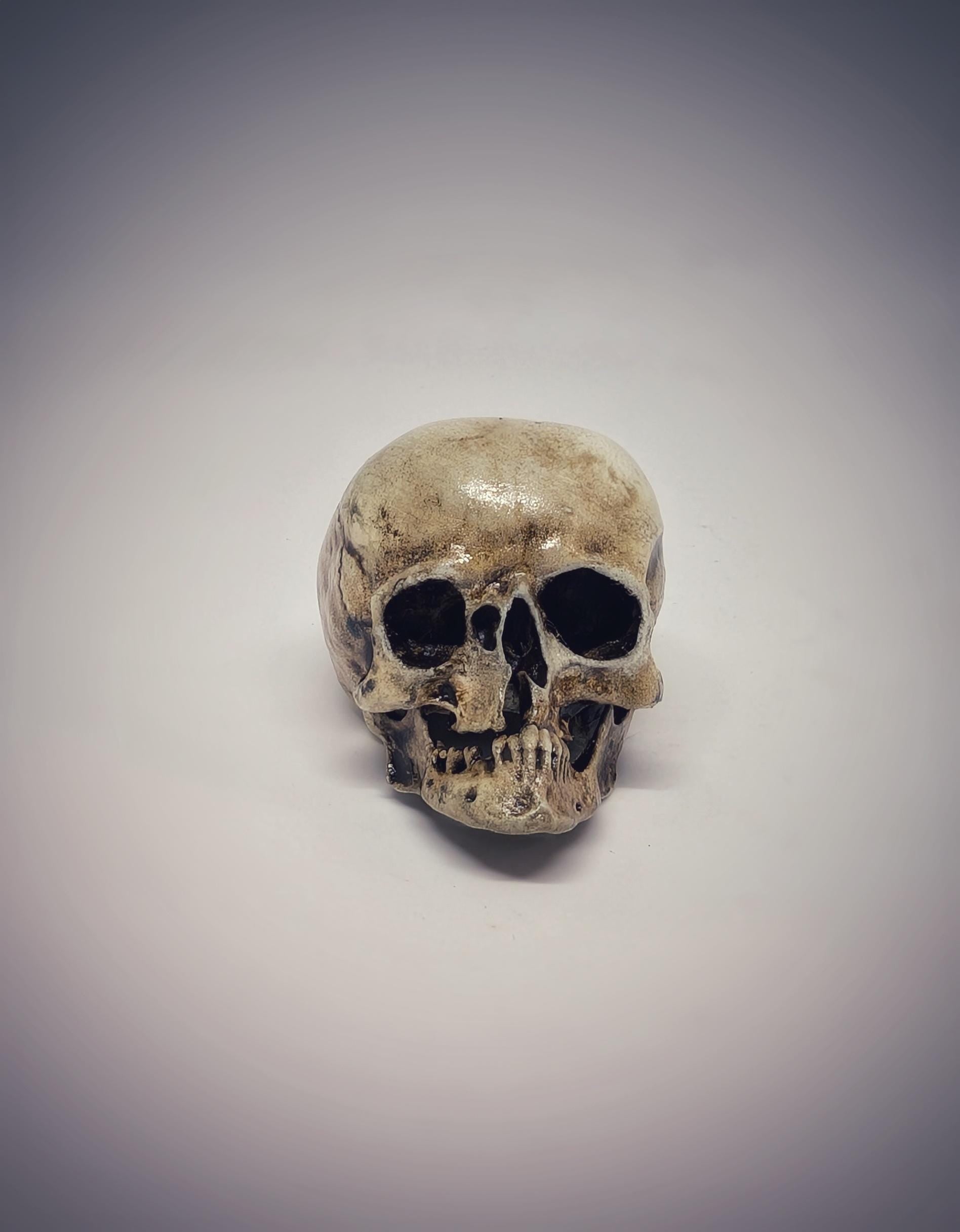 Small Craniosynostosis Skull 3D Resin 1.77 "(4.5 cm) x 2.36"(6 cm) Anatomical