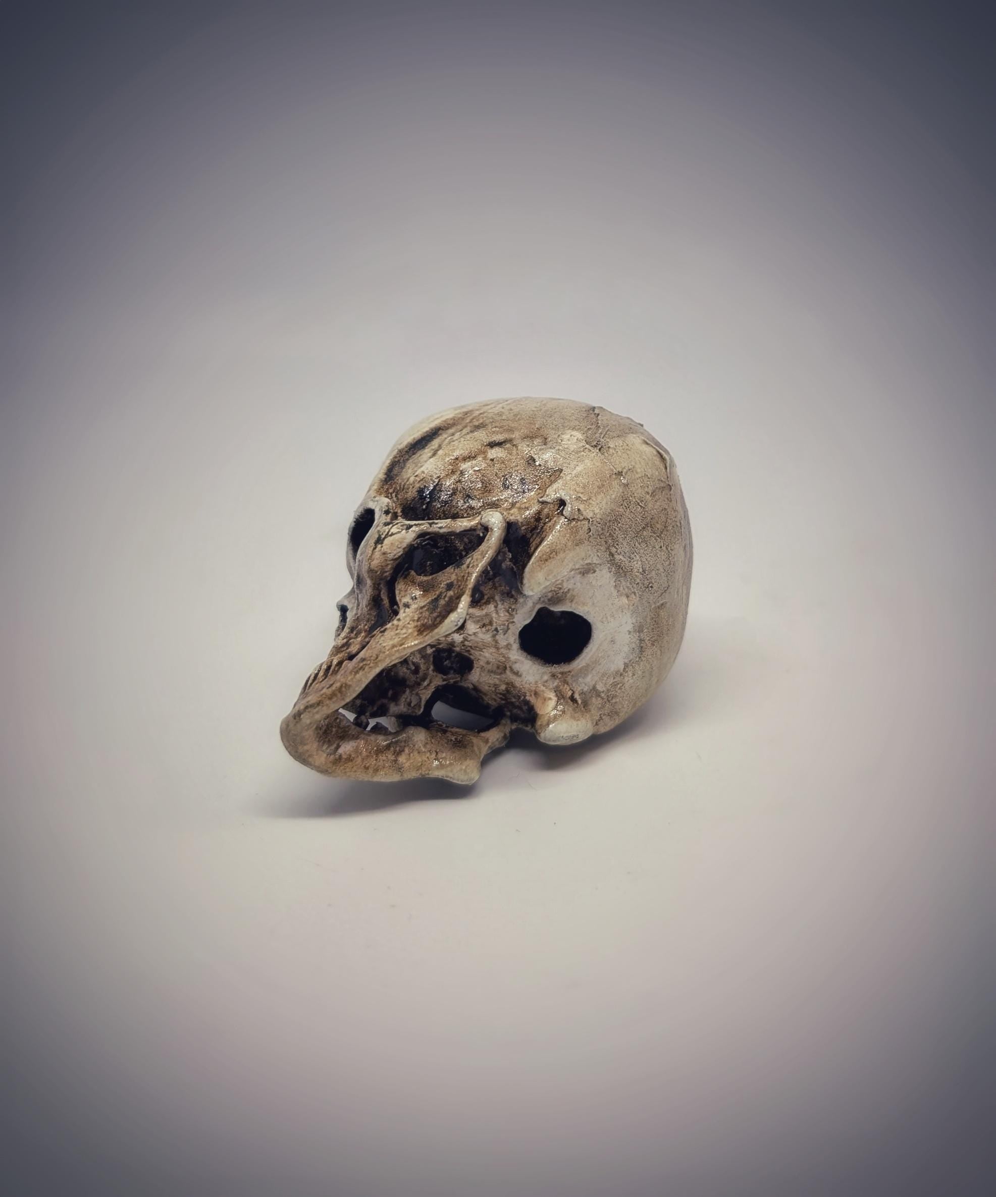 Small Craniosynostosis Skull 3D Resin 1.77 "(4.5 cm) x 2.36"(6 cm) Anatomical