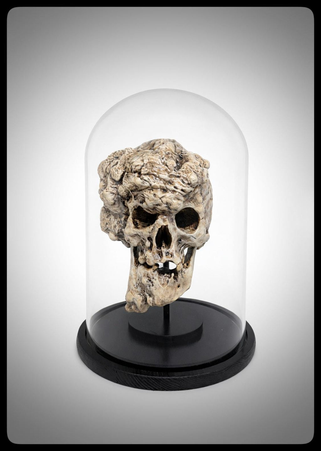 Joseph Merrick Skull 3D Resin Sculpture – 3D Sculpt by Carlito Brigante