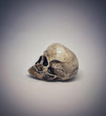 Small Craniosynostosis Skull 3D Resin 1.77 "(4.5 cm) x 2.36"(6 cm) Anatomical