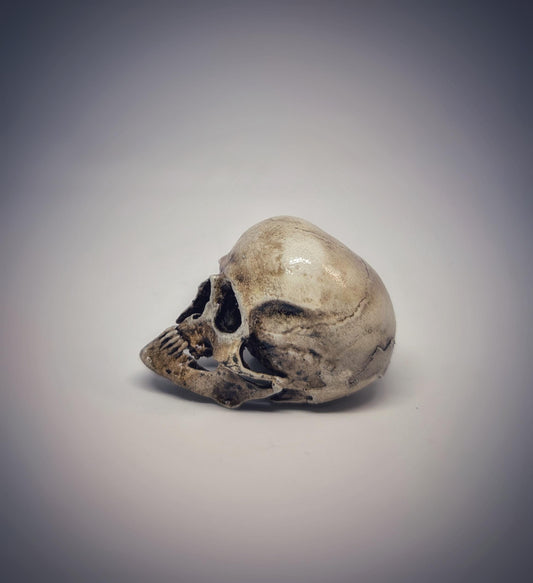 Small Craniosynostosis Skull 3D Resin 1.77 "(4.5 cm) x 2.36"(6 cm) Anatomical