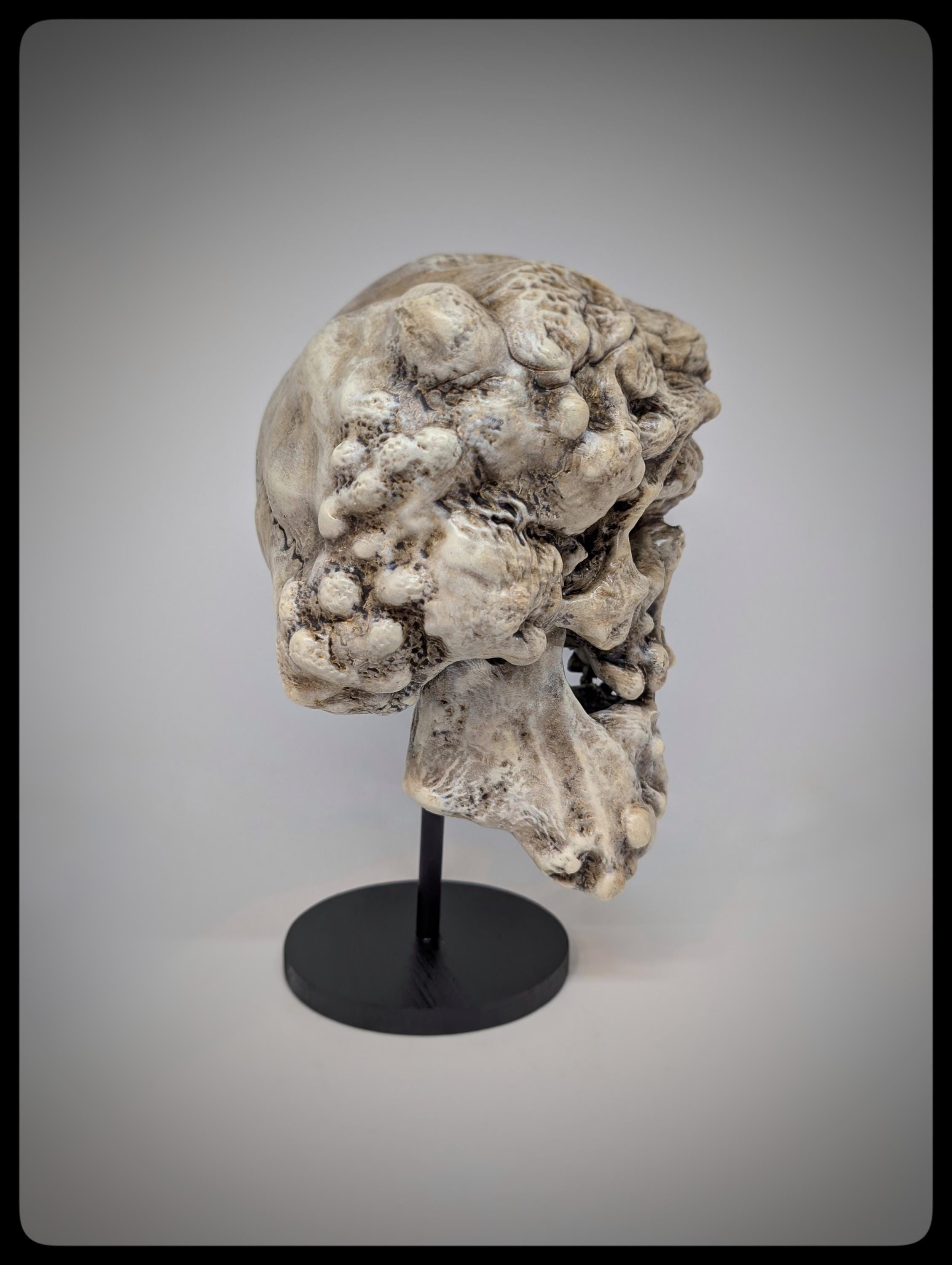 Joseph Merrick Skull 3D Resin Sculpture – 3D Sculpt by Carlito Brigante