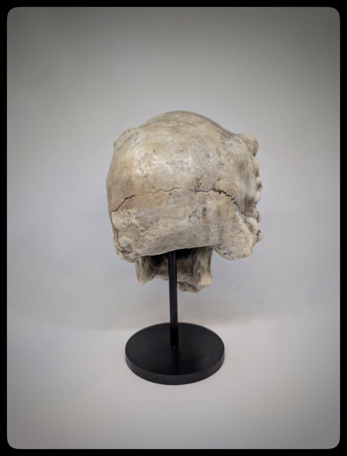 Joseph Merrick Skull 3D Resin Sculpture – 3D Sculpt by Carlito Brigante