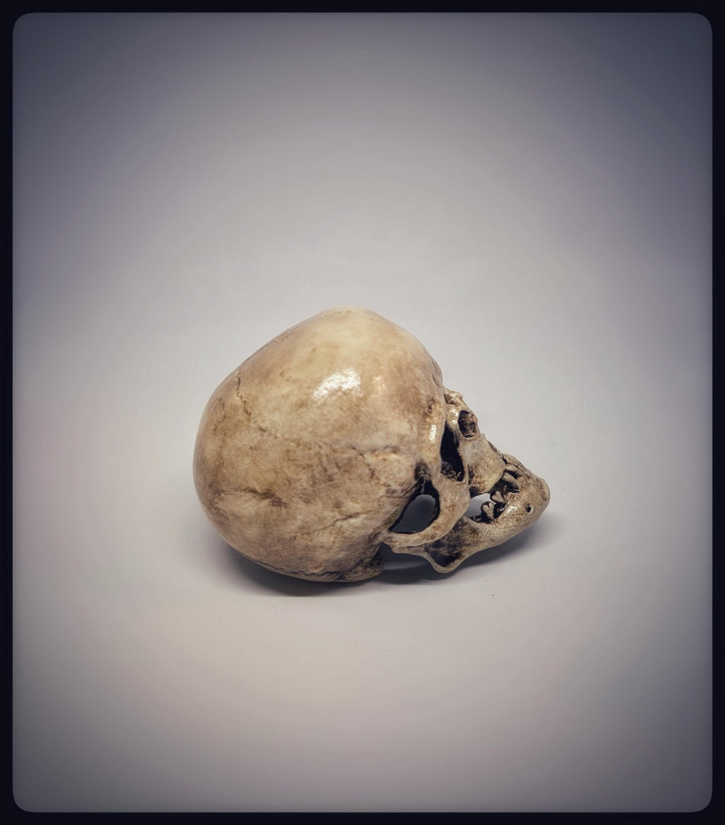 Craniosynostosis Skull 3D Resin Model 2.76x2.95in (7x7.5 cm) Anatomical